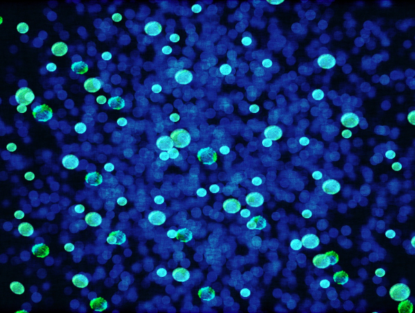 Widziane pod mikroskopem bakterie zabarwione na zielono i niebiesko