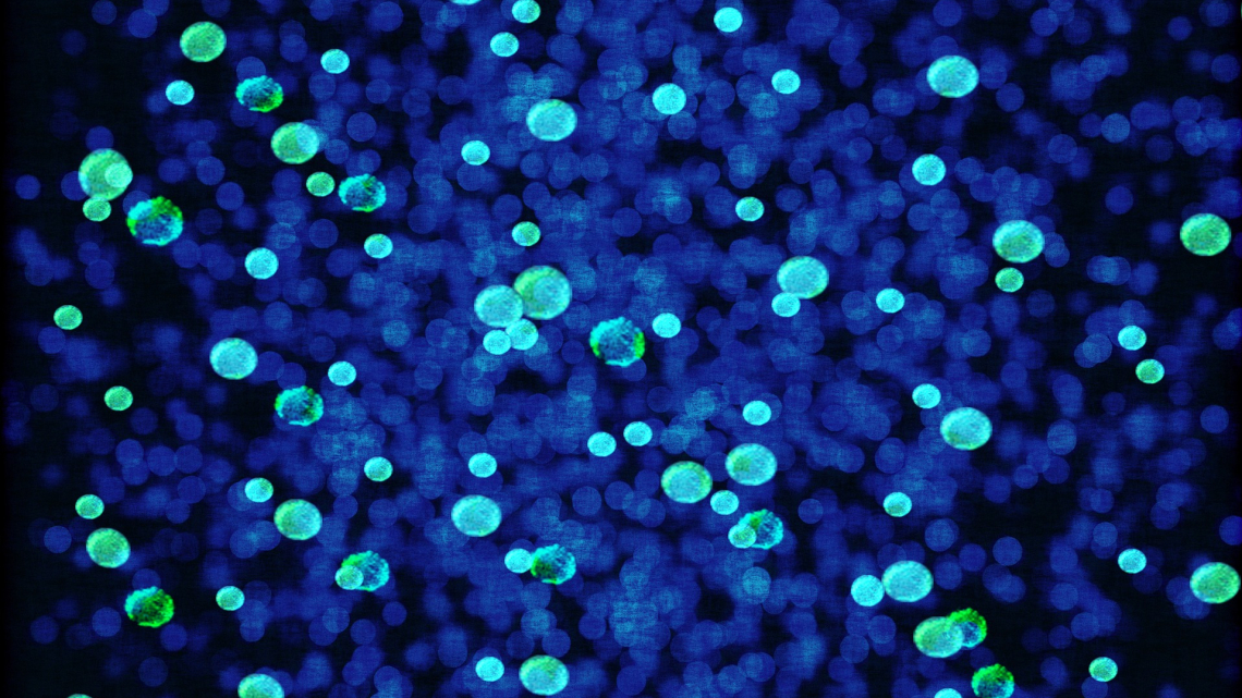 Widziane pod mikroskopem bakterie zabarwione na zielono i niebiesko
